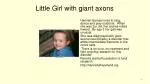 Little Girl with giant axons