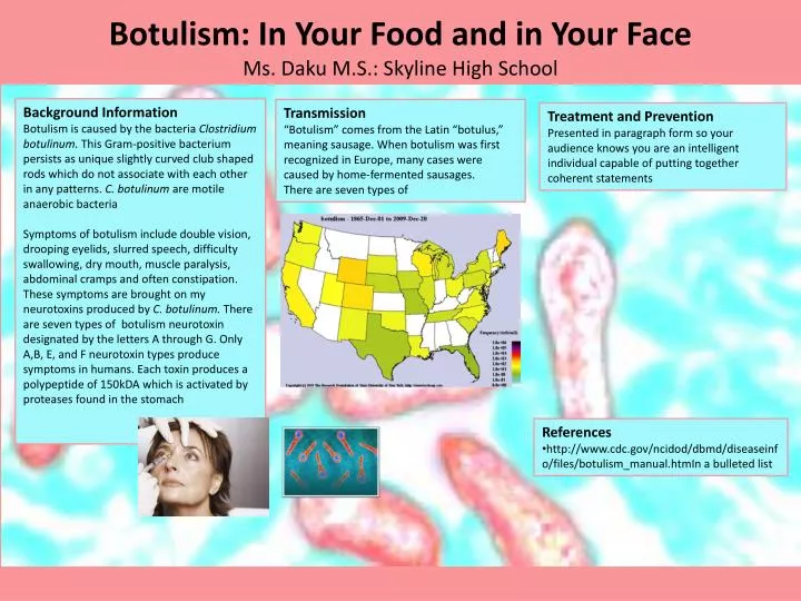 botulism in your f ood and in your f ace ms daku m s skyline high school