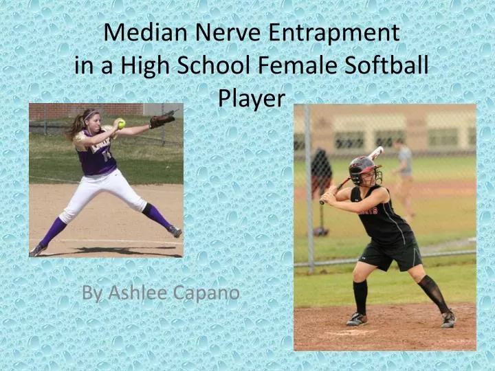 median nerve entrapment in a high school female softball player