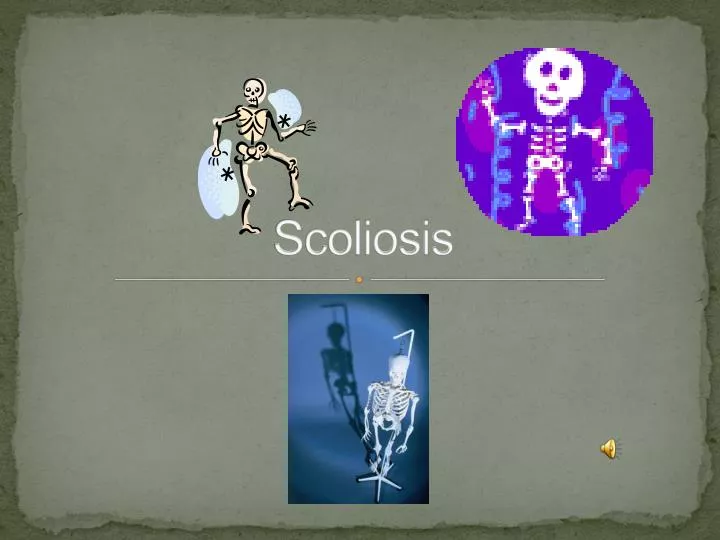 scoliosis