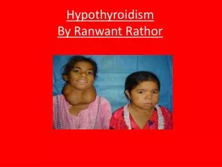 Hypothyroidism By Ranwant Rathor