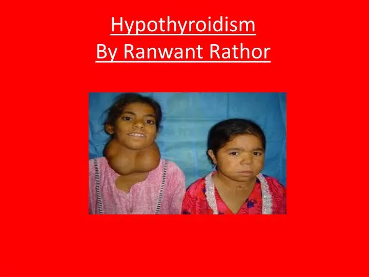 hypothyroidism by ranwant rathor