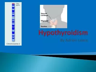 Hypothyroidism