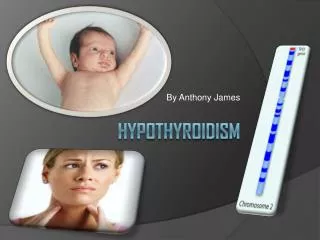 HYPOTHYROIDISM