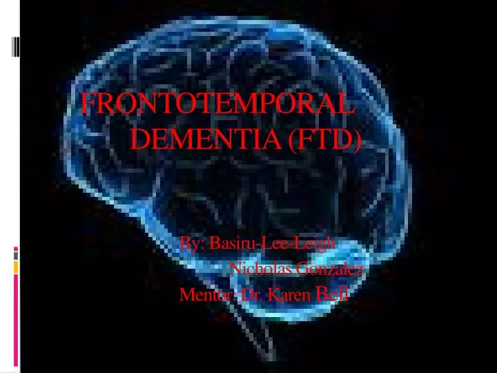 frontotemporal dementia ftd by basiru lee leigh nicholas gonzalez mentor dr karen bell