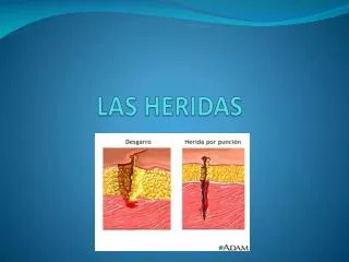 las heridas