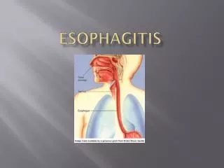 Esophagitis