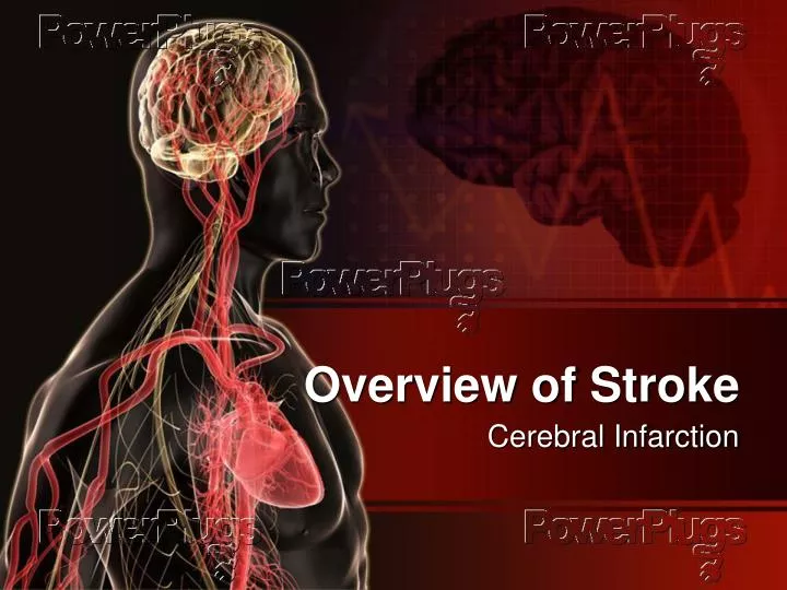 overview of stroke