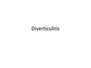 Diverticulitis