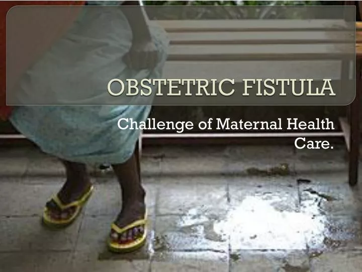 obstetric fistula