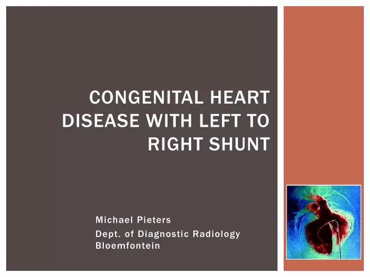 congenital heart disease with left to right shunt