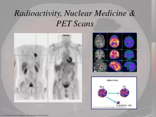Radioactivity, Nuclear Medicine &amp; PET Scans