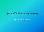 Epidural/Subdural Hematoma