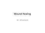 Wound Healing - slide 1