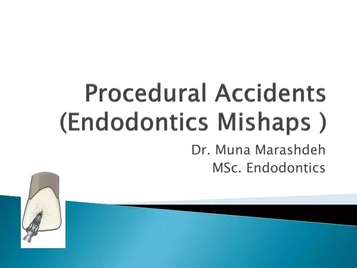 procedural accidents endodontics mishaps