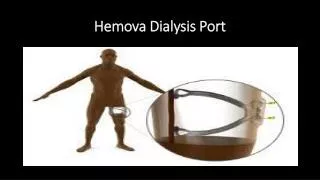 Hemova Dialysis Port