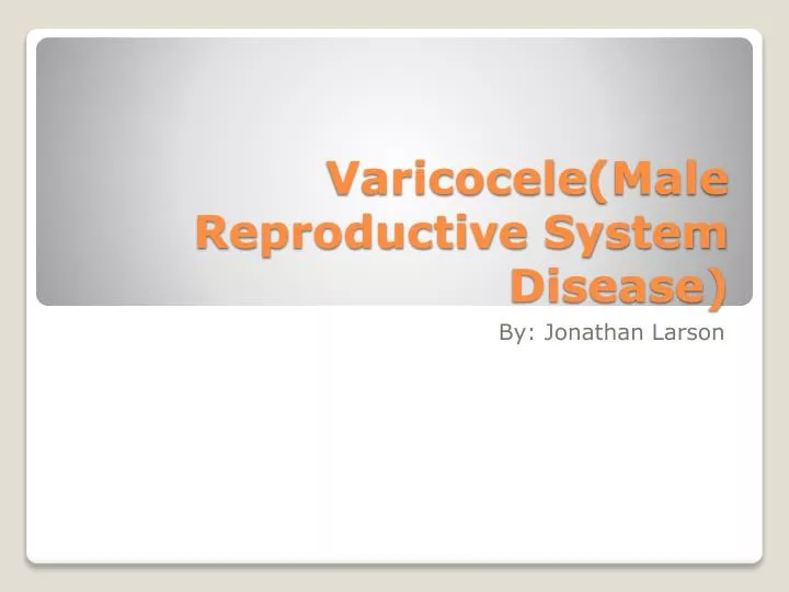 varicocele male reproductive system disease