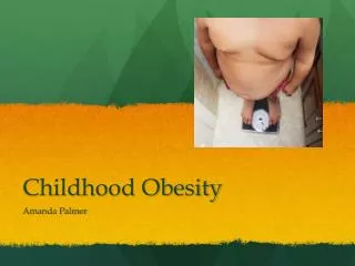 Childhood Obesity