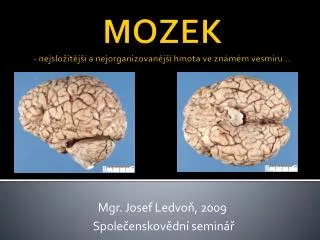 MOZEK - nejsložitější a nejorganizovanější hmota ve známém vesmíru…