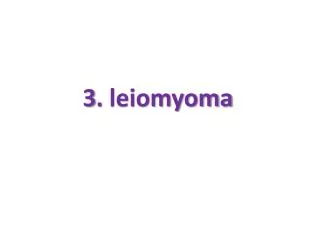 3. leiomyoma