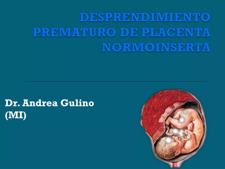 desprendimiento prematuro de placenta normoinserta