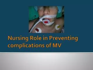 Nursing Role in Preventing complications of MV