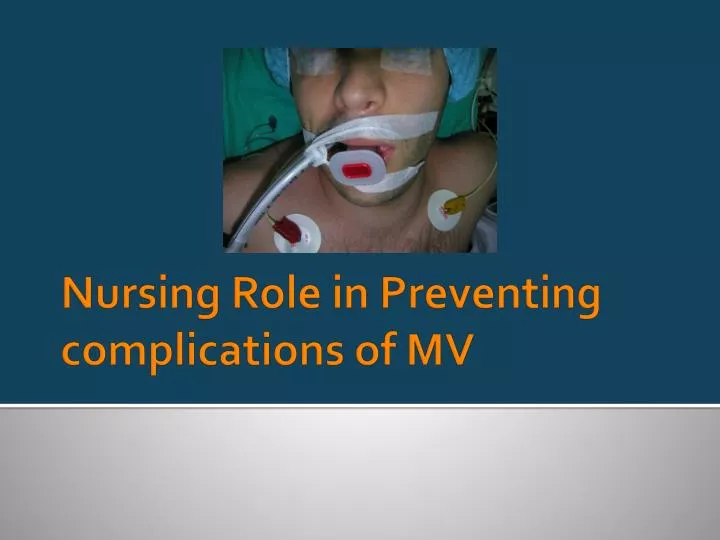 nursing role in preventing complications of mv