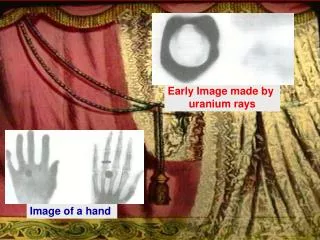 Image of a hand