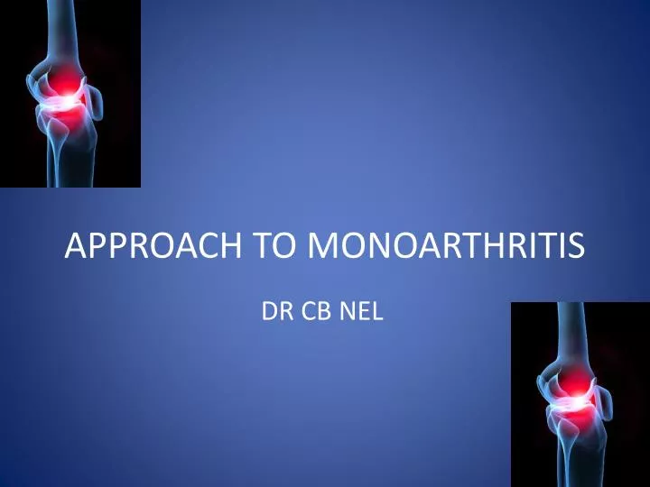 approach to monoarthritis