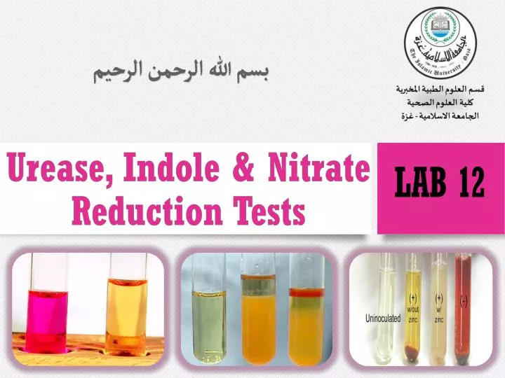 nitrate reduction test e coli