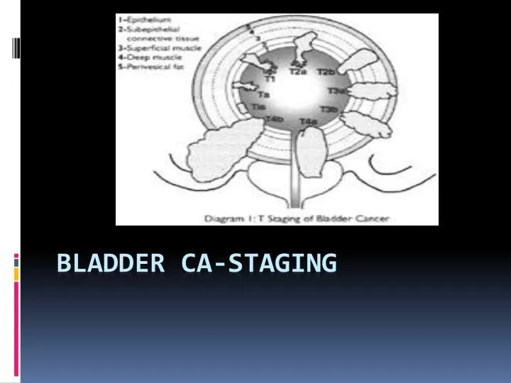 bladder ca staging