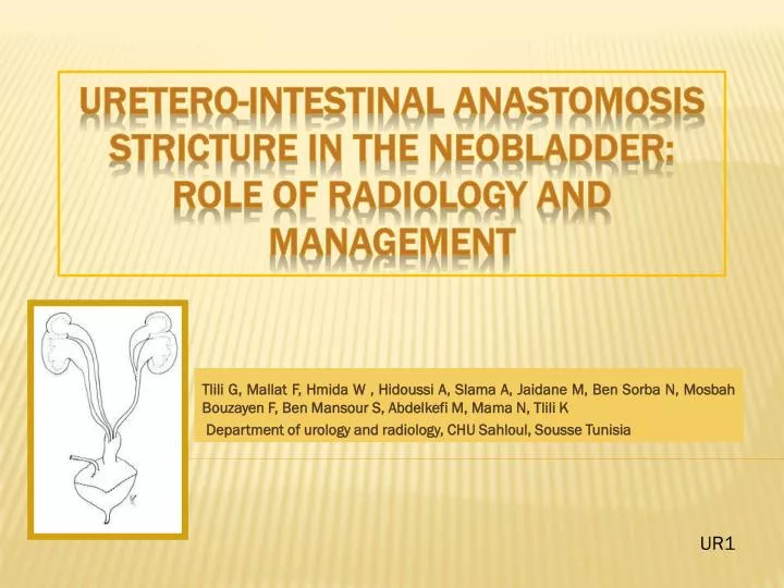 uretero intestinal anastomosis stricture in the neobladder role of radiology and management