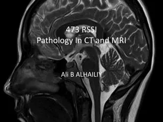 473 RSSI Pathology In CT and MRI
