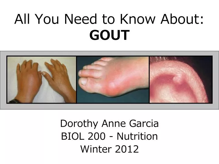 all you need to know about gout
