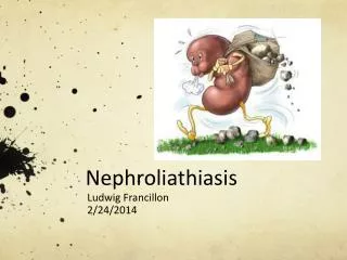 Nephroliathiasis