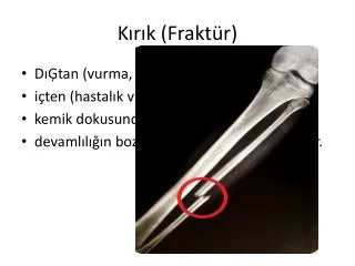 Kırık ( Fraktür )