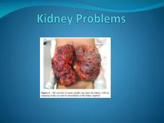 Kidney Problems