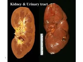 Kidney &amp; Urinary tract