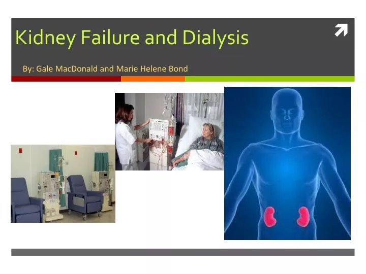 kidney failure and dialysis
