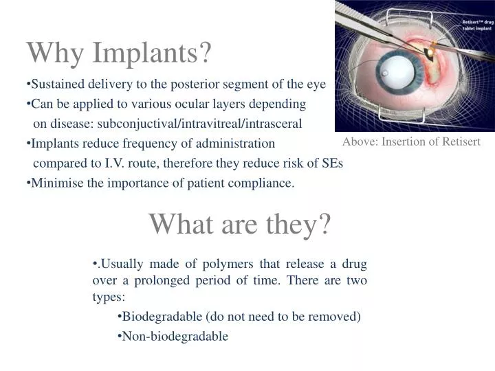 why implants