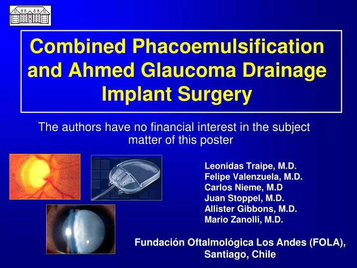 combined phacoemulsification and ahmed glaucoma drainage implant surgery
