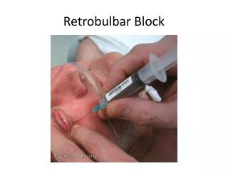 Retrobulbar Block