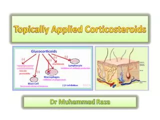 Topically Applied Corticosteroids