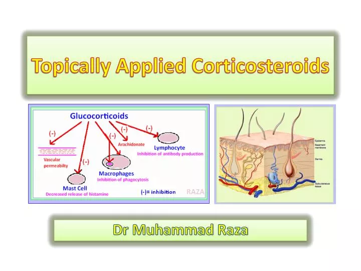 topically applied corticosteroids