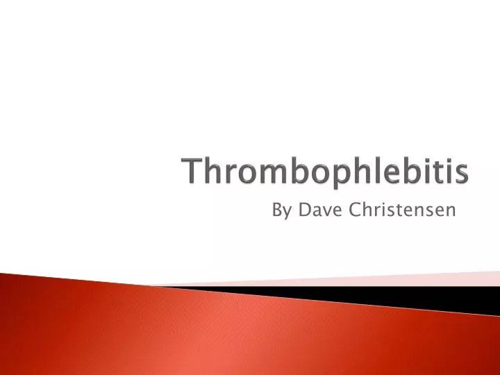 thrombophlebitis