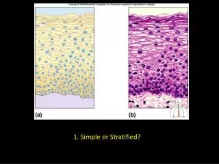 1. Simple or Stratified?