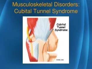Musculoskeletal Disorders: Cubital Tunnel Syndrome