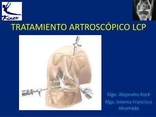 TRATAMIENTO ARTROSCÓPICO LCP