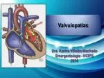 Valvulopatias - slide 1
