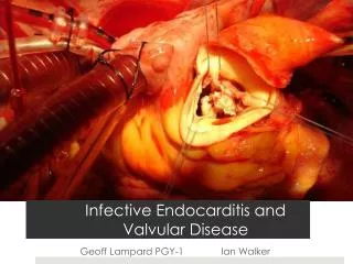 Infective Endocarditis and Valvular Disease